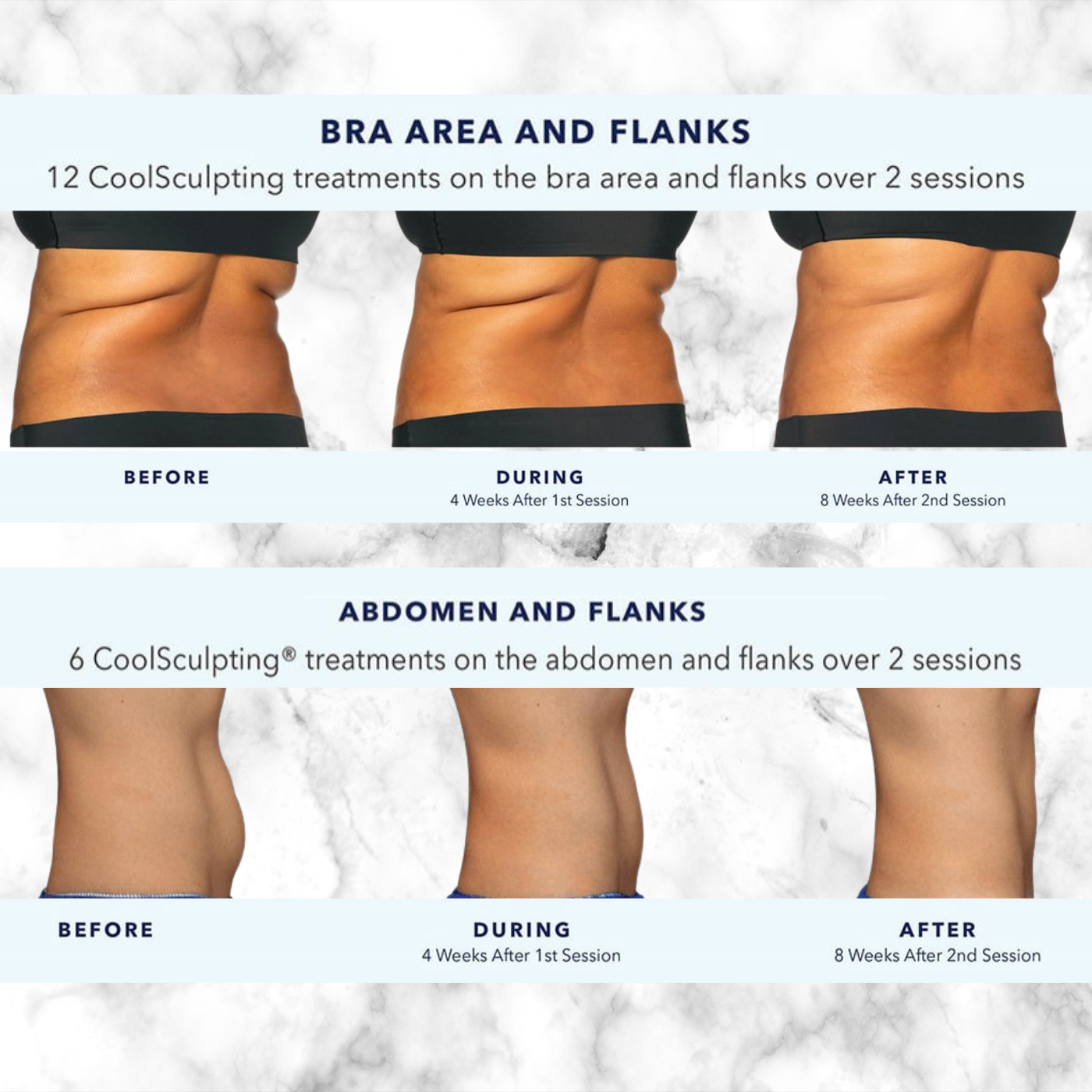 CoolSculpting Elite | PACKAGE of 8