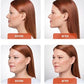 Kybella | Non Surgical Double Chin Removal $100 OFF