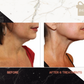 FULL FACE SKIN TIGHTENING PACKAGE OF 6