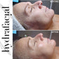 Hydrafacial Deal Buy 2 Get 1 FREE | Limited Time Offer