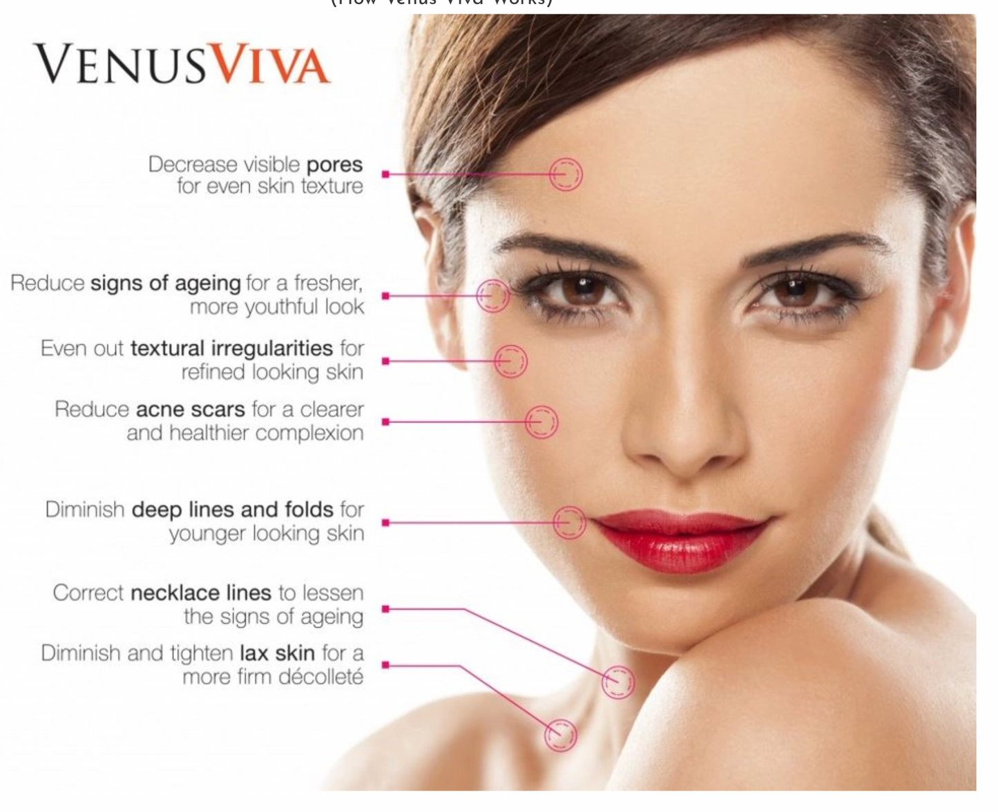 VENUS VIVA | SKIN RE-SURFACING | Package of 3