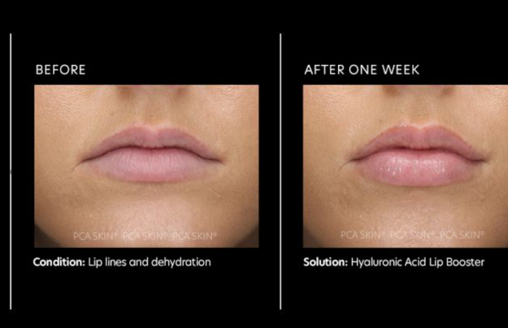 PCA SKIN | Hyaluronic Acid Lip Booster