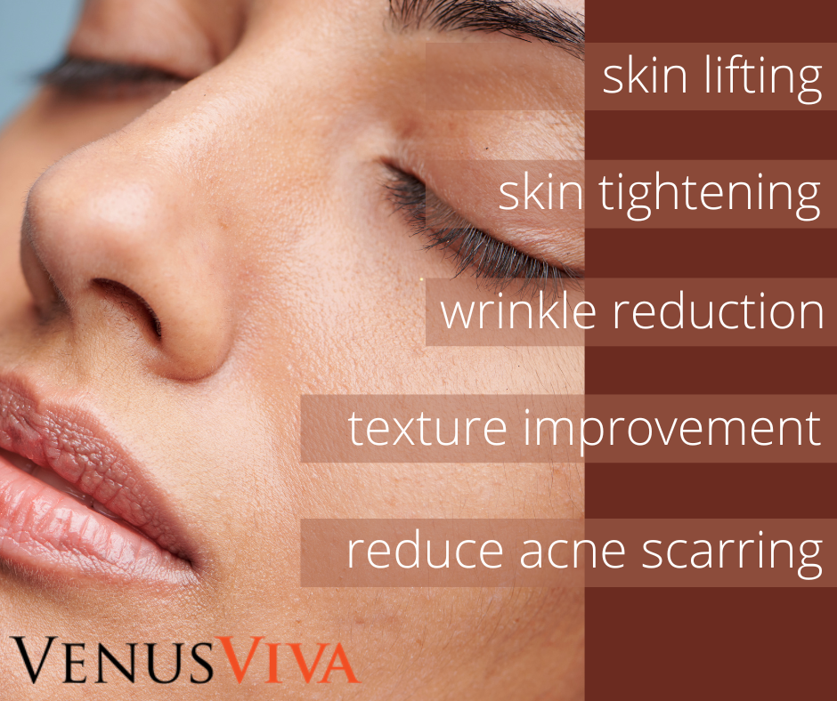 VENUS VIVA | SKIN RE-SURFACING | Package of 3